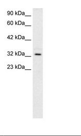 Fetal Muscle Lysate.