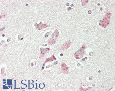Human Brain, Cortex: Formalin-Fixed, Paraffin-Embedded (FFPE)
