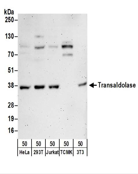 Detection of Human and Mouse Transaldolase by Western Blot. Samples: Whole cell lysate (50 ug) from HeLa, 293T, Jurkat, mouse TCMK-1, and mouse NIH3T3 cells. Antibodies: Affinity purified rabbit anti-Transaldolase antibody used for WB at 0.1 ug/ml. Detection: Chemiluminescence with an exposure time of 3 minutes.
