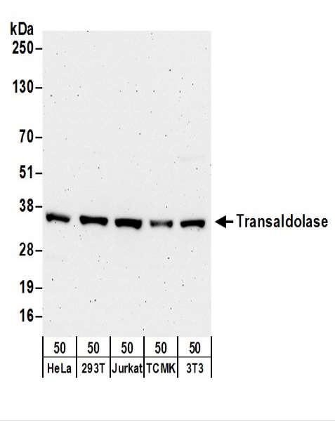 Detection of Human and Mouse Transaldolase by Western Blot. Samples: Whole cell lysate (50 ug) from HeLa, 293T, Jurkat, mouse TCMK-1, and mouse NIH3T3 cells. Antibodies: Affinity purified rabbit anti-Transaldolase antibody used for WB at 0.4 ug/ml. Detection: Chemiluminescence with an exposure time of 3 minutes.