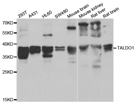 Western blot analysis of extracts of various cell lines, using TALDO1 antibody.
