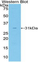 Western blot of recombinant TALDO1 / TAL.