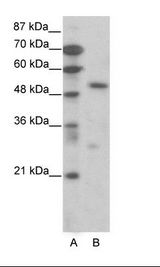 A: Marker, B: Jurkat Cell Lysate