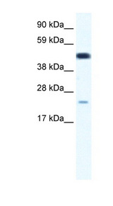 TCF7 antibody LS-B1003 Western blot of Fetal thymus lysate.