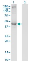 Western Blot analysis of TCN2 expression in transfected 293T cell line by TCN2 monoclonal antibody (M01), clone 2F4.Lane 1: TCN2 transfected lysate (Predicted MW: 47.5 KDa).Lane 2: Non-transfected lysate.