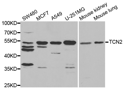 Western blot analysis of extracts of various cell lines, using TCN2 antibody.