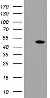 HEK293T cells were transfected with the pCMV6-ENTRY control (Left lane) or pCMV6-ENTRY TDO2 (Right lane) cDNA for 48 hrs and lysed. Equivalent amounts of cell lysates (5 ug per lane) were separated by SDS-PAGE and immunoblotted with anti-TDO2.