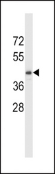 TDO2 Antibody western blot of MDA-MB453 cell line lysates (35 ug/lane). The TDO2 antibody detected the TDO2 protein (arrow).