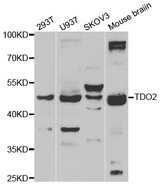 Western blot analysis of extracts of various cell lines, using TDO2 antibody.