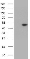 HEK293T cells were transfected with the pCMV6-ENTRY control (Left lane) or pCMV6-ENTRY TDO2 (Right lane) cDNA for 48 hrs and lysed. Equivalent amounts of cell lysates (5 ug per lane) were separated by SDS-PAGE and immunoblotted with anti-TDO2.
