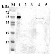 Western blot analysis using anti-TDO (human), pAb at 1:2000 dilution. 1: Human TDO (His-tagged). 2: Human IDO (His-tagged). 3: Mouse IDO (His-tagged). 4: SH-sy5y cell lysate. 5: Unrelated protein (His-tagged) (negative control).
