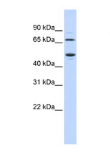 TDO2 antibody LS-B5791 Western blot of Fetal Heart lysate. Antibody concentration 1 ug/ml.