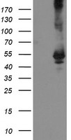 HEK293T cells were transfected with the pCMV6-ENTRY control (Left lane) or pCMV6-ENTRY TDO2 (Right lane) cDNA for 48 hrs and lysed. Equivalent amounts of cell lysates (5 ug per lane) were separated by SDS-PAGE and immunoblotted with anti-TDO2.