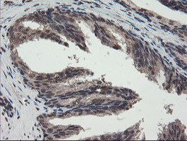 IHC of paraffin-embedded Human prostate tissue using anti-TDO2 mouse monoclonal antibody.