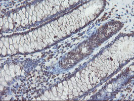 IHC of paraffin-embedded Human colon tissue using anti-TDO2 mouse monoclonal antibody.