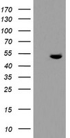 HEK293T cells were transfected with the pCMV6-ENTRY control (Left lane) or pCMV6-ENTRY TDO2 (Right lane) cDNA for 48 hrs and lysed. Equivalent amounts of cell lysates (5 ug per lane) were separated by SDS-PAGE and immunoblotted with anti-TDO2.
