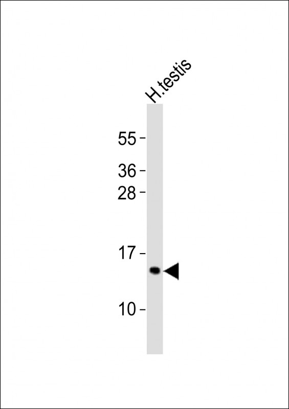 Anti-PCP2 Antibody at 1:1000 dilution + human testis lysates Lysates/proteins at 20 ug per lane. Secondary Goat Anti-Rabbit IgG, (H+L), Peroxidase conjugated at 1/10000 dilution Predicted band size : 15 kDa Blocking/Dilution buffer: 5% NFDM/TBST.