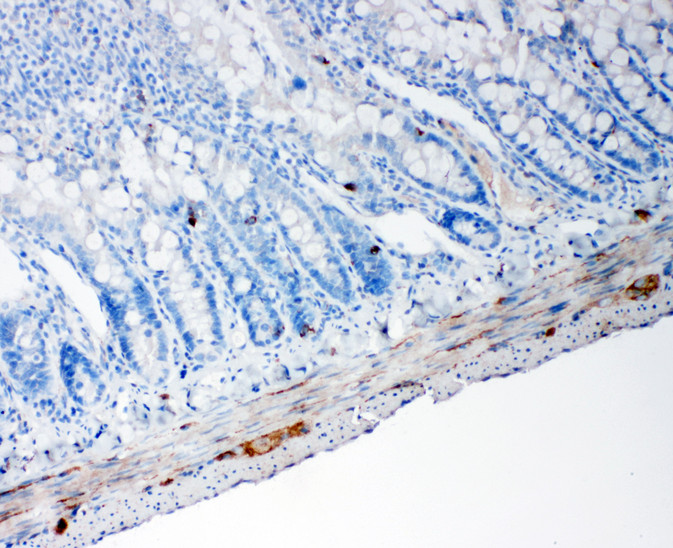 PCSK1 / PC1 antibody. IHC(P): Rat Intestine Tissue.