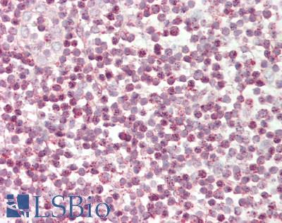 Human Tonsil: Formalin-Fixed, Paraffin-Embedded (FFPE)