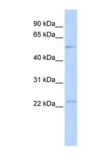 TFDP1 / Dp-1 antibody LS-C112313 Western blot of MCF7 Cell lysate. Antibody concentration 1 ug/ml.