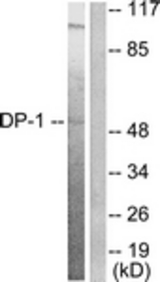 Western blot of extracts from HeLa cells, using DP-1 Antibody. The lane on the right is treated with the synthesized peptide.