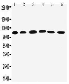 WB of PCSK1 / PC1 antibody. Lane 1: Rat Liver Tissue Lysate. Lane 2: Rat Thymus Tissue Lysate. Lane 3: A549 Cell Lysate. Lane 4: HELA Cell Lysate. Lane 5: COLO320 Cell Lysate. Lane 6: PANC Cell Lysate.
