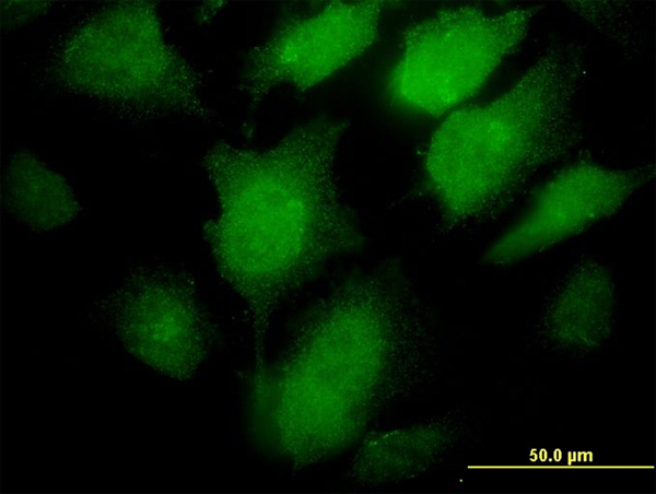 Immunofluorescence of monoclonal antibody to PCSK1 on HeLa cell. [antibody concentration 30 ug/ml]