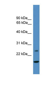 TFPI2 antibody LS-C116881 Western blot of MCF7 cell lysate.