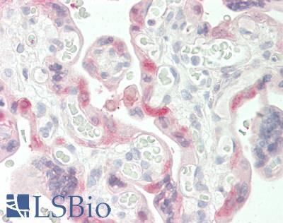 Human Placenta: Formalin-Fixed, Paraffin-Embedded (FFPE)