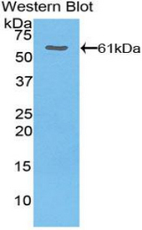 Western blot of recombinant Thrombospondin 4 / THBS4.