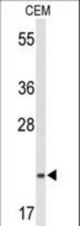 Western blot of TIFA Antibody in CEM cell line lysates (35 ug/lane). TIFA (arrow) was detected using the purified antibody.