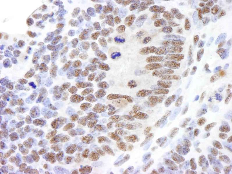 Detection of Mouse Timeless by Immunohistochemistry. Sample: FFPE section of mouse teratoma. Antibody: Affinity purified rabbit anti-Timeless used at a dilution of 1:250.