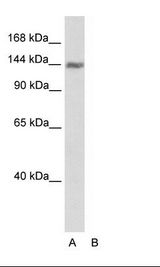 Transfected 293T Cell Lysate