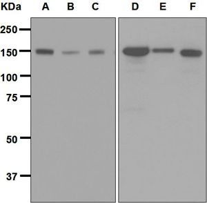 Western blot analysis on (A) Jurkat, (B) HeLa, (C) JAR, (D) RAW 264.7, (E) PC-12, and (F) NIH/3T3 cell lysates using anti-Timeless antibody.