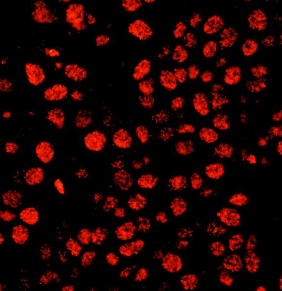 Detection of Human Timeless by Immunofluorescence. Sample: FFPE section of human breast carcinoma. Antibody: Affinity purified rabbit anti-Timeless used at a dilution of 1:400 (0.5 ug/ml). Detection: Red-fluorescent Goat anti-Rabbit IgG-heavy and light chain cross-adsorbed Antibody DyLight 594 Conjugated (A120-601D4) used at a dilution of 1:100.