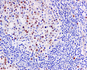IHC of paraffin-embedded human tonsil tissue using anti-Timeless antibody.