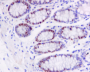 IHC of paraffin-embedded human colon tissue using anti-Timeless antibody.