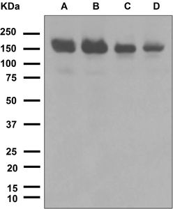 Western blot analysis on (A) HeLa, (B) Jurkat, (C) JAR, and (D) BxPC-3 cell lysates using anti-Timeless antibody.