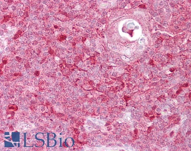 Anti-TIMELESS antibody IHC of human thymus. Immunohistochemistry of formalin-fixed, paraffin-embedded tissue after heat-induced antigen retrieval. Antibody LS-B6788 concentration 5 ug/ml.