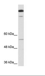Transfected 293T Cell Lysate.