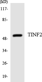 Western blot of the lysates from HeLa cells using TINF2 antibody.
