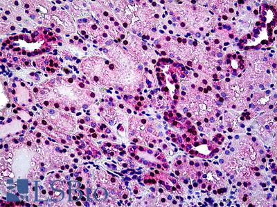Anti-TINF2 antibody IHC of human kidney. Immunohistochemistry of formalin-fixed, paraffin-embedded tissue after heat-induced antigen retrieval. Antibody LS-B5124 concentration 3.75 ug/ml.