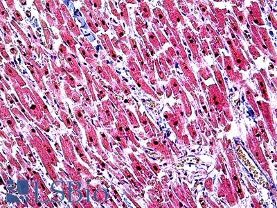 Anti-TINF2 antibody IHC of human heart. Immunohistochemistry of formalin-fixed, paraffin-embedded tissue after heat-induced antigen retrieval. Antibody LS-B5124 concentration 3.75 ug/ml.