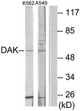 Western blot of extracts from K562/A549 cells, using DAK Antibody. The lane on the right is treated with the synthesized peptide.