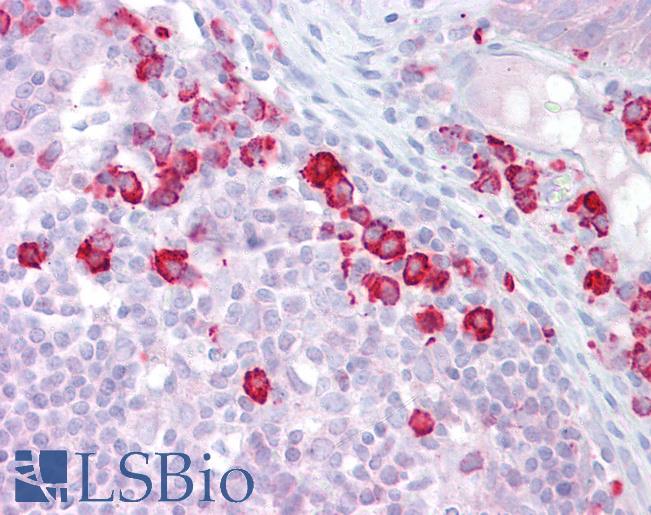 Anti-DAK antibody IHC of human tonsil. Immunohistochemistry of formalin-fixed, paraffin-embedded tissue after heat-induced antigen retrieval. Antibody LS-B6633 concentration 5 ug/ml.
