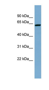 DAK antibody LS-B6633 Western blot of OVCAR-3 cell lysate.