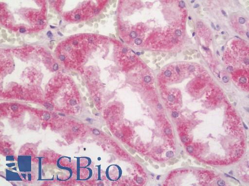 Human Kidney: Formalin-Fixed, Paraffin-Embedded (FFPE)