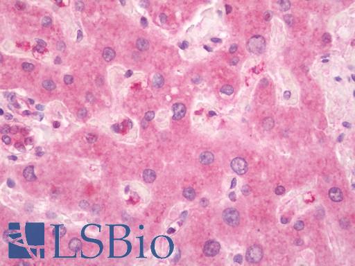Human Liver: Formalin-Fixed, Paraffin-Embedded (FFPE)