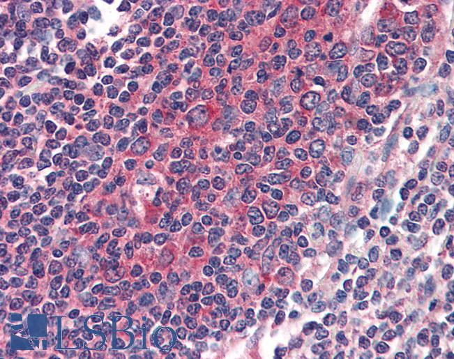 Anti-PD1 antibody IHC of human small intestine, Peyer's patch. Immunohistochemistry of formalin-fixed, paraffin-embedded tissue after heat-induced antigen retrieval. Antibody LS-B2551 concentration 5 ug/ml.