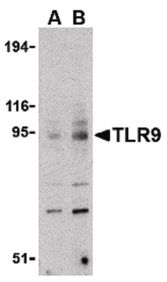 Western blot of TLR9 in mouse spleen cell lysate with TLR9 antibody at (A) 0.5, (B) 1 and (C) 2 ug/ml.